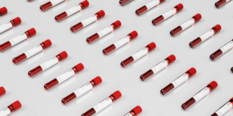 Blood Work: Your Runway to Optimal Health & Longevity